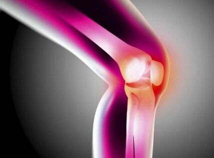 Arthrose verformen