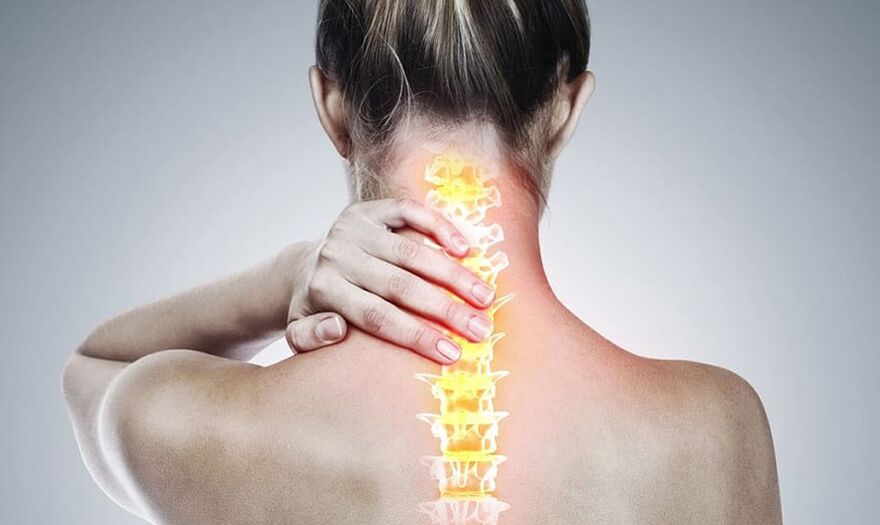 Osteochondrose der Halswirbelsäule